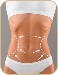 abdominiplastia