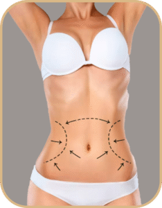 lipoaspiração hd