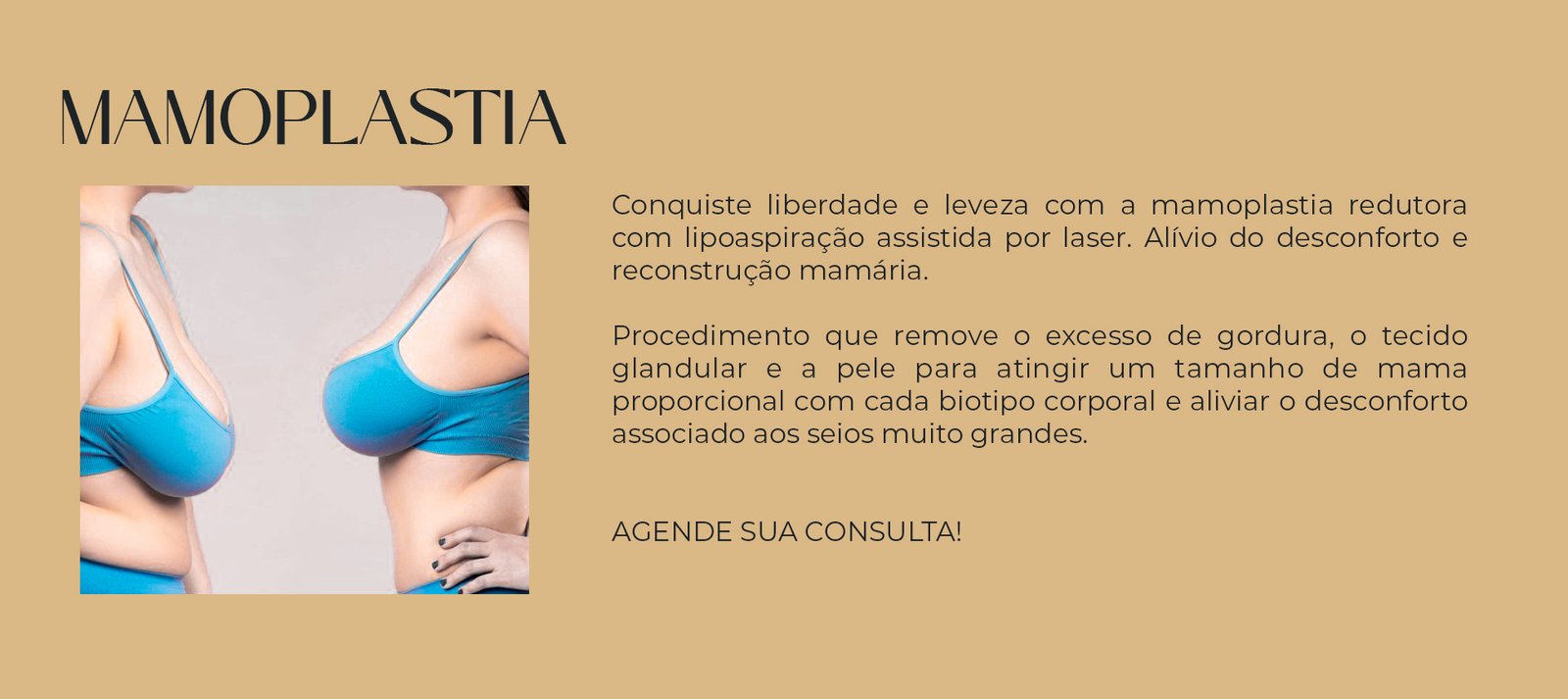 mamoplastia