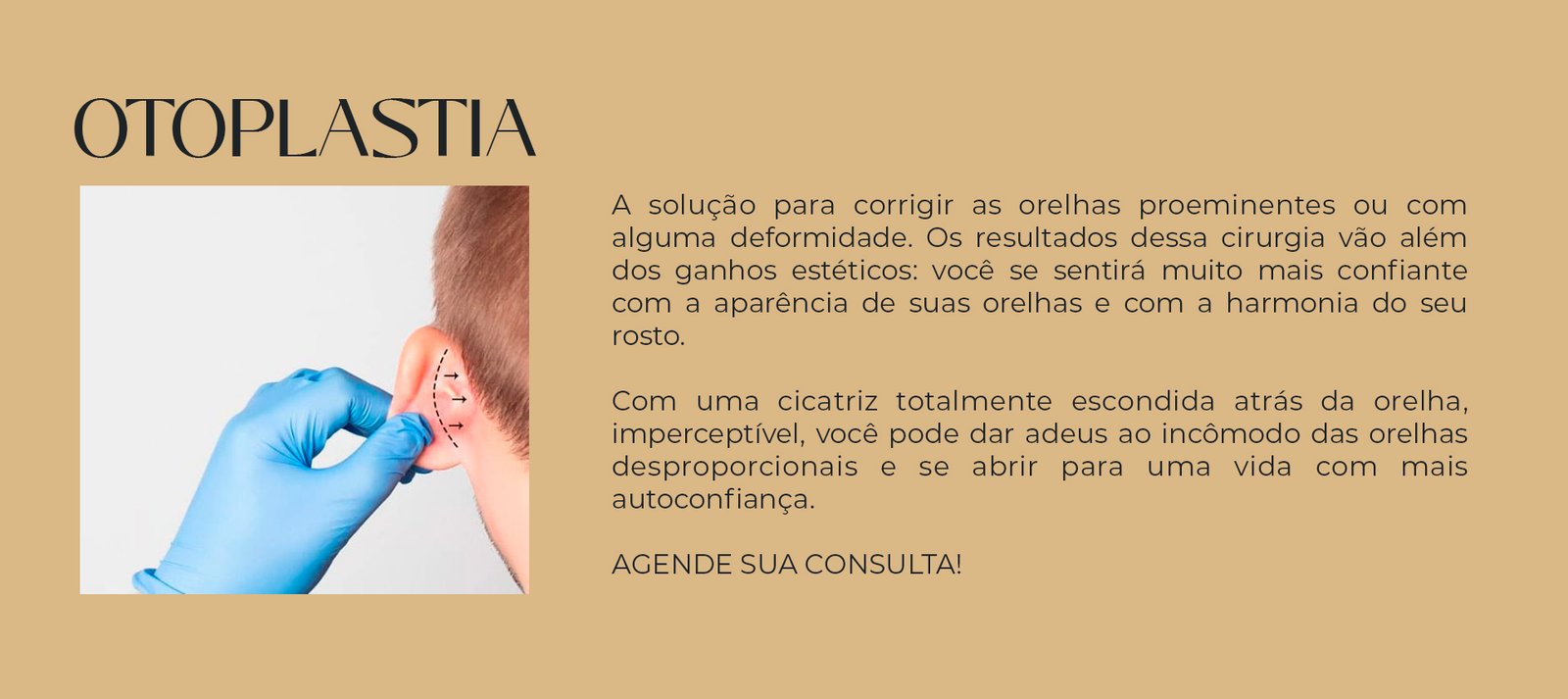 otoplastia 2