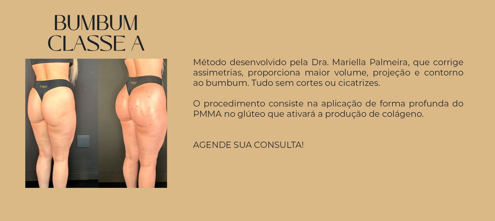 bumbum classe a
