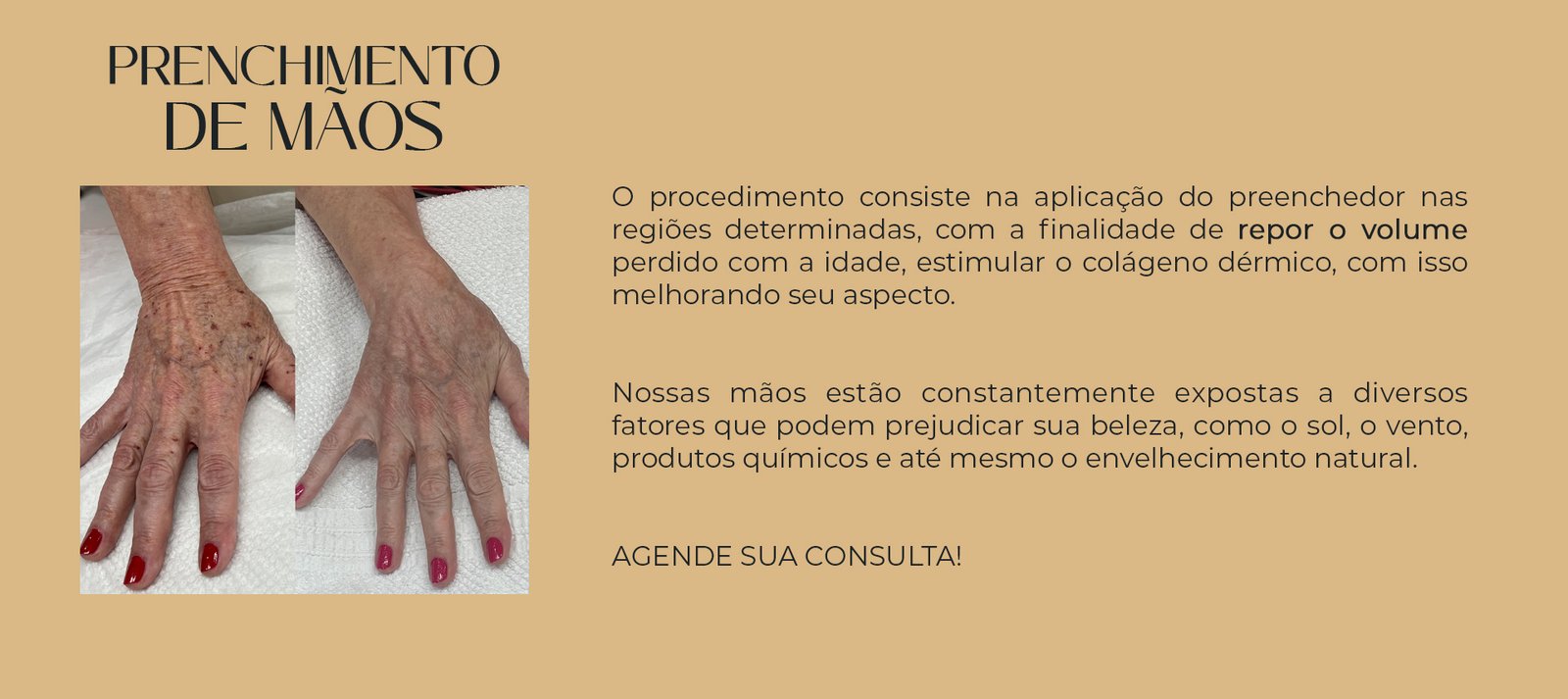 harmonização de maos