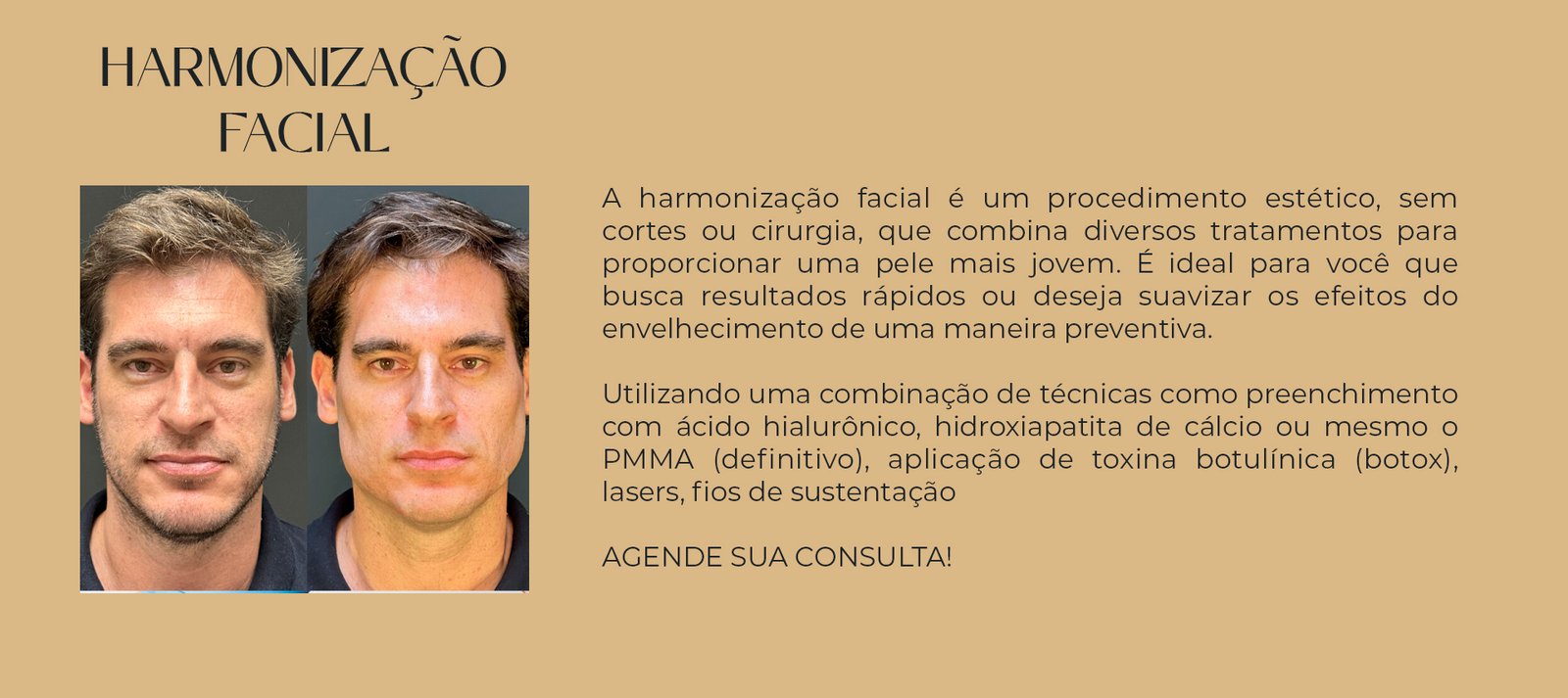 harmonização facial
